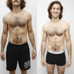 CryoSlimming - Abdomen CryoSlimming - Abdomen